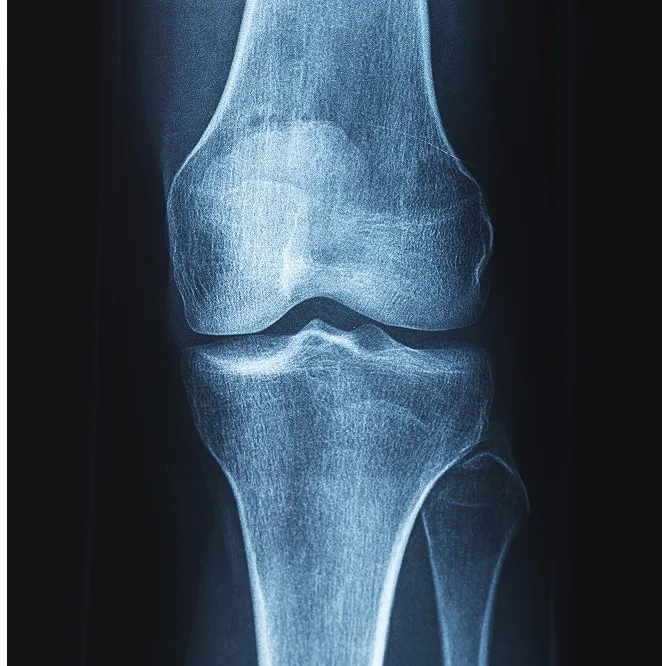 Clinical X-ray used for hip and knee assessment